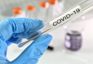 rapid_test-999x658-1