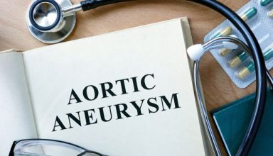 bigstock-Aortic-aneurysm