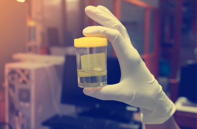 Urine2