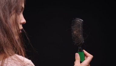 hair_loss