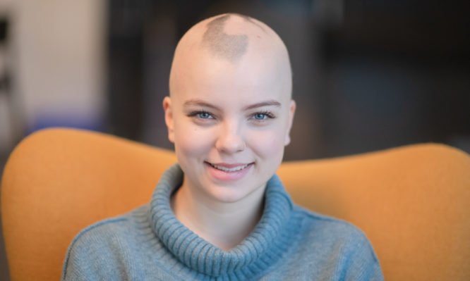 A beautiful young woman with a chronic illness sits in her chair while looking into the camera. She is bald because she is battling breast cancer.